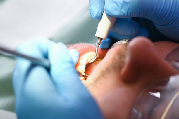 Best Dentist for Tooth Abscess  in Dover Beaches South, NJ